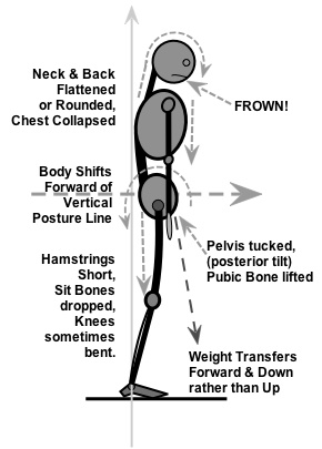 Postural Collapse & Distortion resolved with clinical / medical massage therapy and structural bodywork